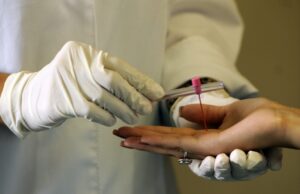 SES reforça ações contra a hanseníase em Mato Grosso